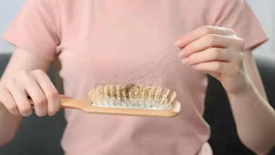 ریزش مو در نوجوانی